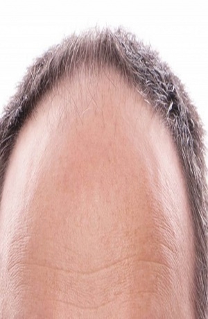 Medicamento estimularía el crecimiento de cabello
