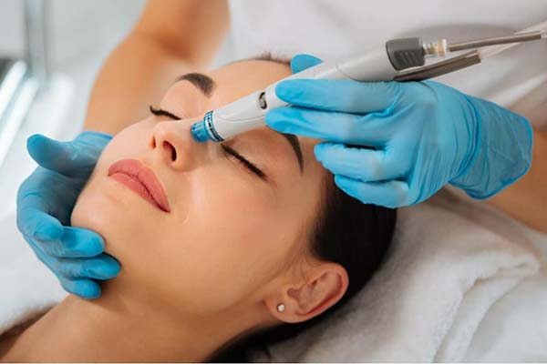 HydraFacial, el mejor tratamiento para tu piel