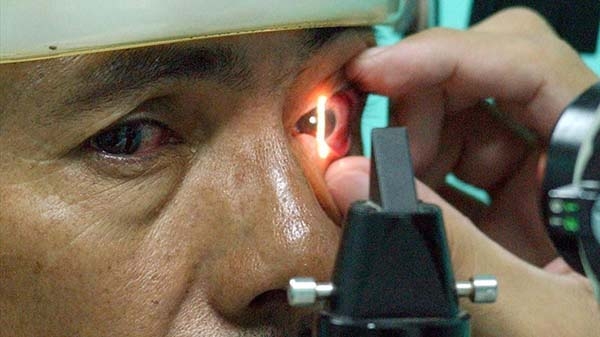 El 2% de la población puede padecer glaucoma, la segunda enfermedad que causa ceguera irreversible: IMSS Puebla