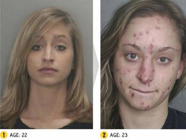 El antes y después de adictos a las drogas