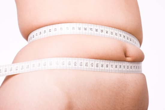 Cirugía de obesidad ¿es una opción segura para perder peso?