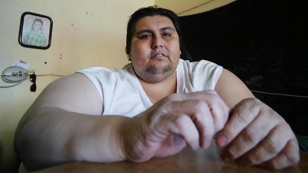 Murió mexicano que fue considerado el hombre más obeso del mundo