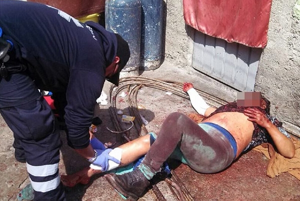 Perros pitbull atacan y matan a mujer en Edomex
