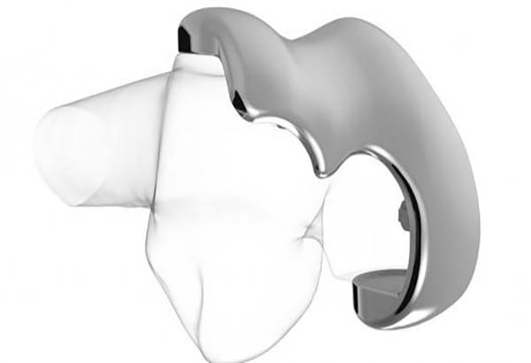 La impresión en 3D permite crear implante de rodilla personalizado