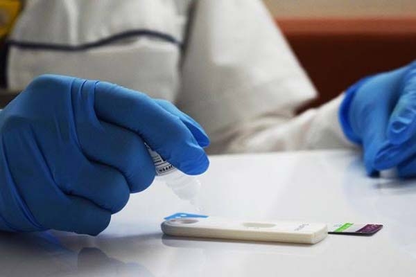 Coesida denuncia desinterés del gobierno estatal sobre el VIH