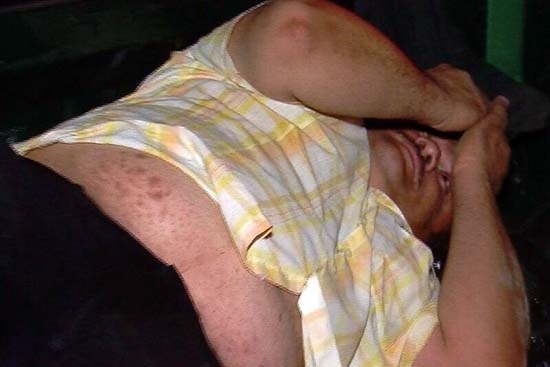 Regidor ebrio golpea a mesera y lo dejan libre por fuero en Campeche