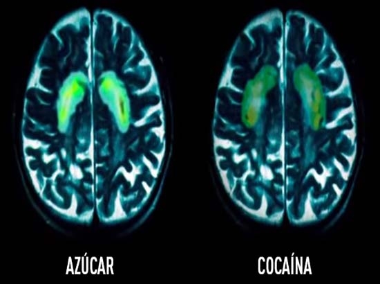Esto hacen el azúcar y la cocaína al cerebro