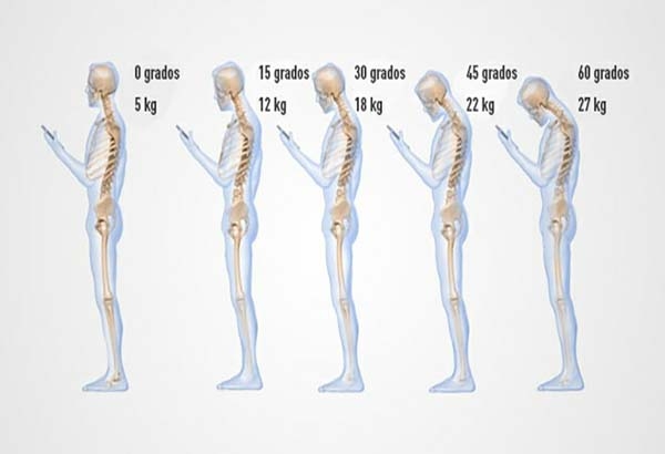 ¿Qué daño hace a las cervicales mirar constantemente el celular?