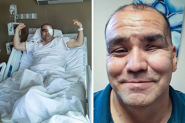 “Lloraba de dolor”: sobreviviente del Hongo Negro