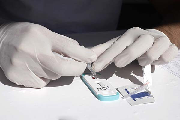 Día Mundial contra el SIDA: solo uno de cada 10 pacientes en Puebla recibió tratamiento