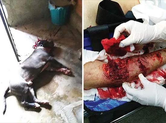 Pitbull le destroza el brazo a su dueña en el Edomex
