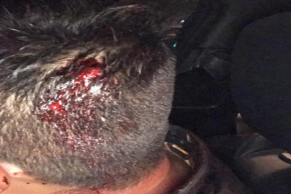 Taxistas de la CAPU descalabran a hombre por competencia con UBER; pierden licencia