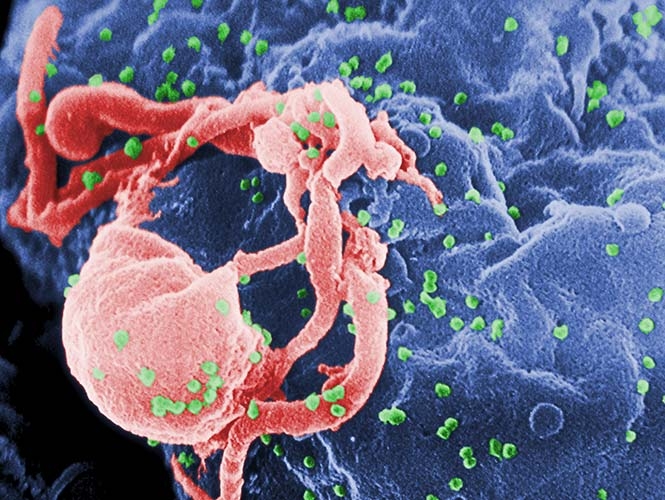 Científicos eliminan VIH de células humanas