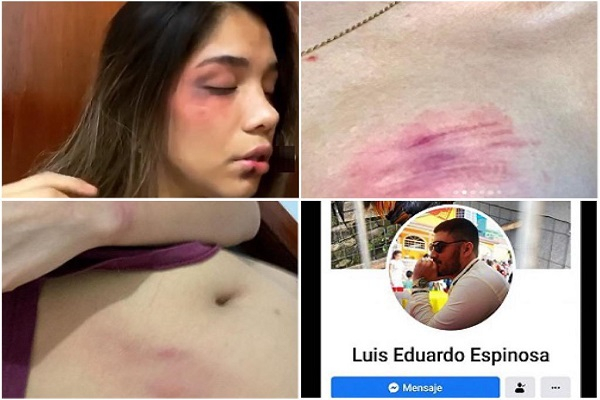VIDEO: Montserrat, poblana que denuncia a expareja en redes tras ser golpeada