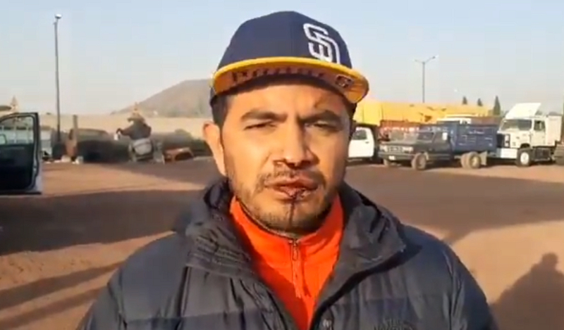 Maleantes golpearon y asaltaron a diputado Uruviel González en su casa en Tlachichuca