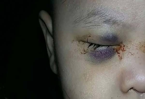 Libre, médico que extirpó ojo sano a bebé en Sonora