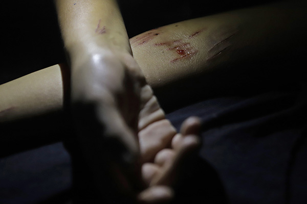 Cada 28 horas se reporta un intento de suicidio en la capital poblana: 911