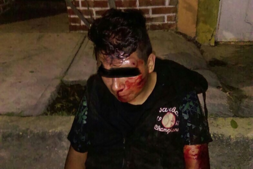 Vecinos de la colonia San Rafael golpean al ladrón de una mochila